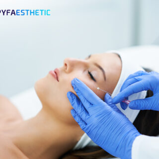 bagaimana cara mengatasi memar setelah tanam benang? Berikut informasi selengkapnya.