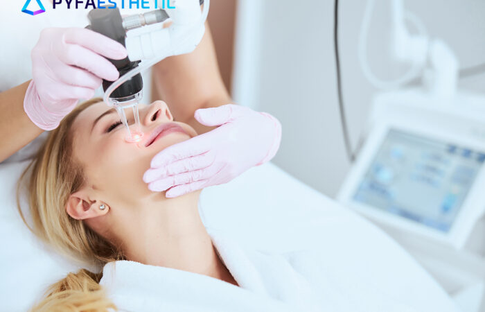 Laser CO2, Terapi CO2 untuk Kulit Tampak Awet Muda