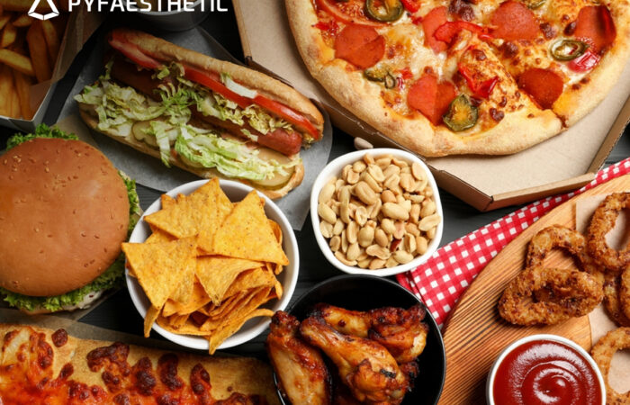 Makanan Penyebab Jerawat yang Perlu Dibatasi