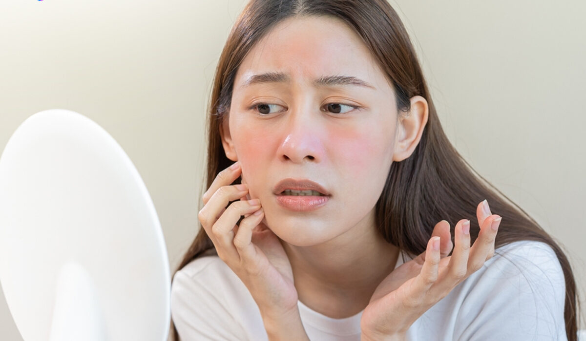 Perbedaan Kulit Sensitif dan Acne Prone