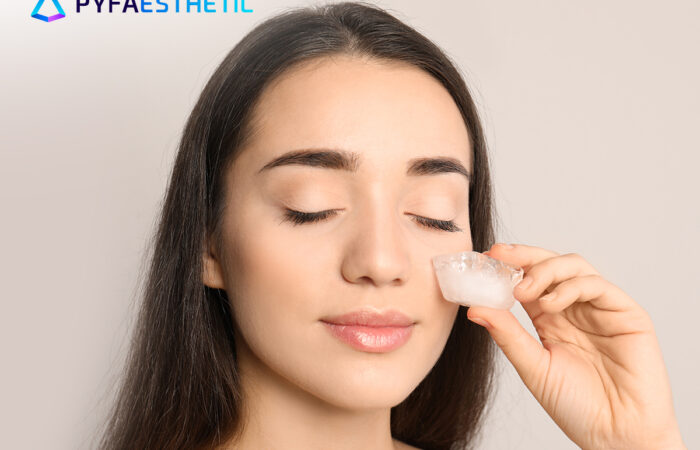 Cara Mengatasi Jerawat Secara Alami