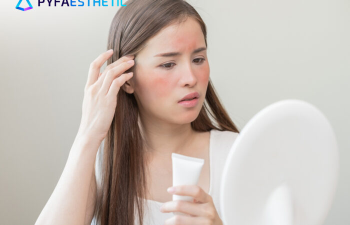 Cara Merawat Kulit Wajah yang Sensitif