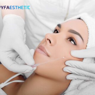 Mengenal Apa Itu Molding Cog pada Prosedur Tanam Benang