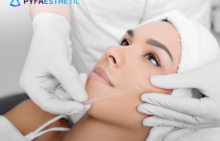 Mengenal Apa Itu Molding Cog pada Prosedur Tanam Benang