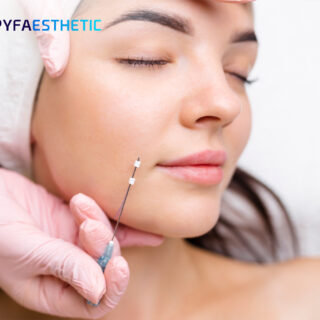 Mengenal Tanam Benang dengan Bahan PLACL