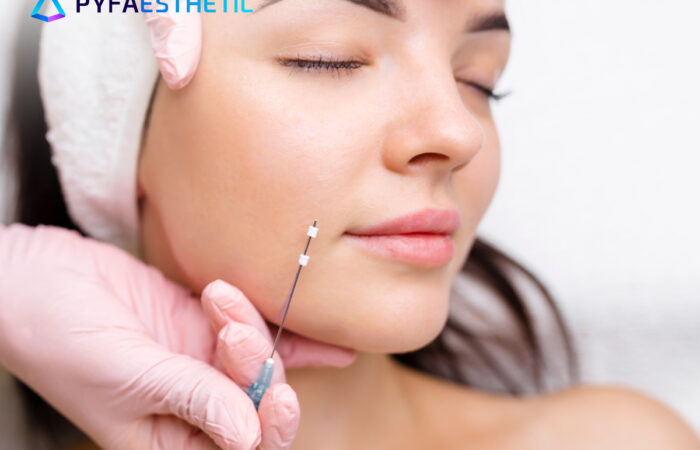 Mengenal Tanam Benang dengan Bahan PLACL