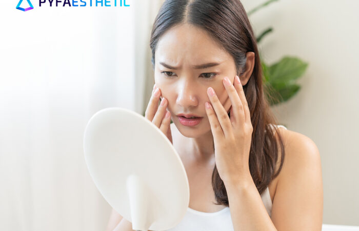 Apa yang Menyebabkan Kulit Kendur