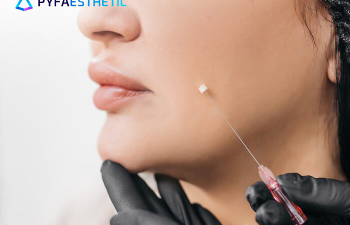 Tanam Benang Wajah, Manfaat dan Prosedur