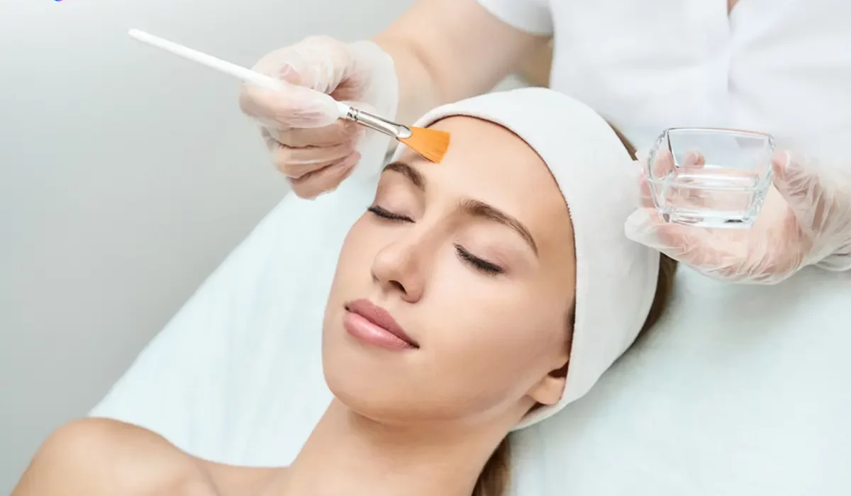 Apakah Chemical Peeling Cocok untuk Kulit Berjerawat, Ini Penjelasannya