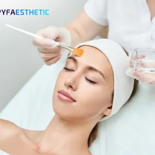 Apakah Chemical Peeling Cocok untuk Kulit Berjerawat, Ini Penjelasannya