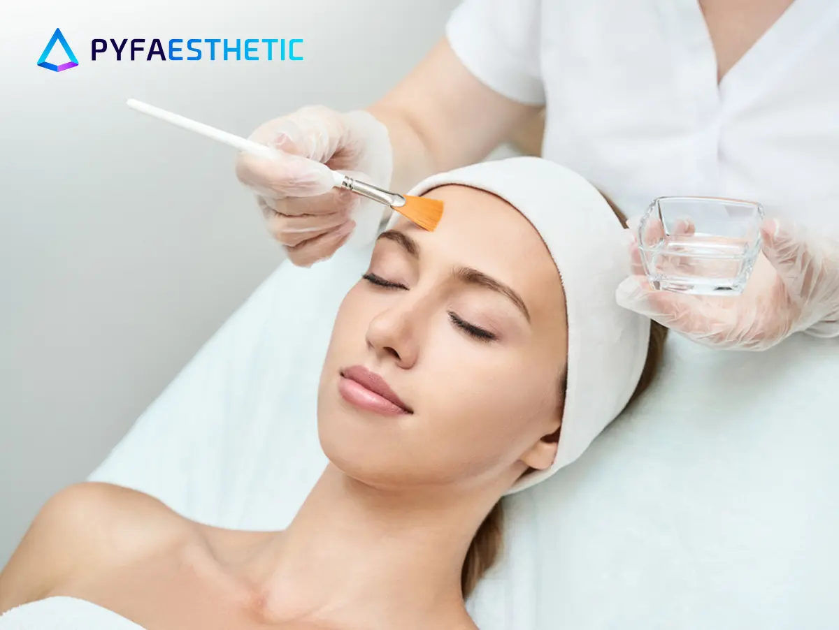 Apakah Chemical Peeling Cocok untuk Kulit Berjerawat, Ini Penjelasannya