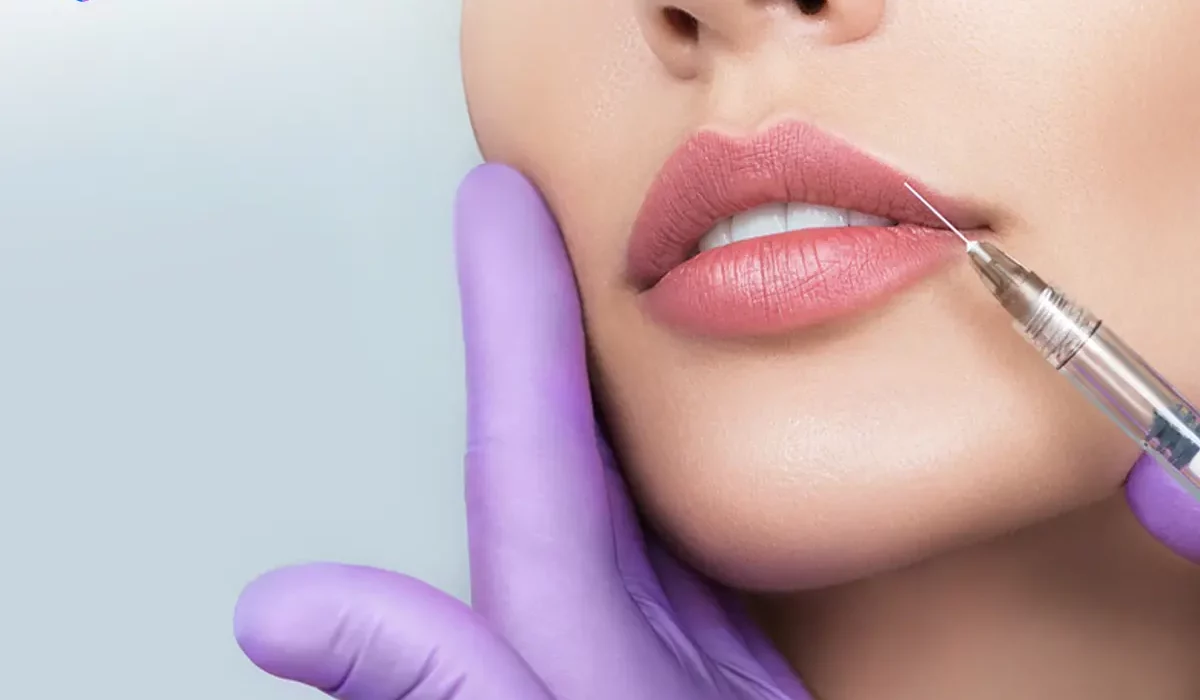 Beragam Kegunaan Hyaluronic Acid untuk Filler Bibir