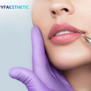 Beragam Kegunaan Hyaluronic Acid untuk Filler Bibir