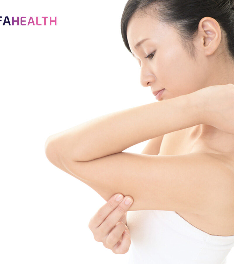 Cara Efektif Mengencangkan Kulit Kendur Setelah Diet