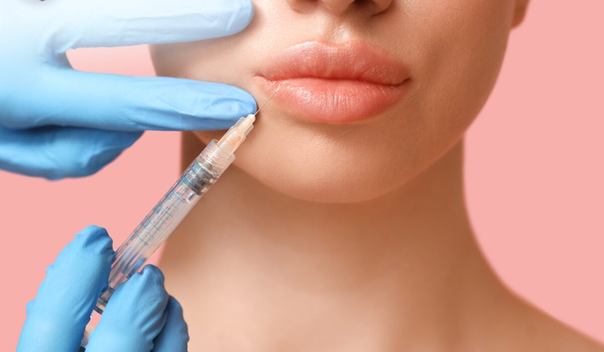 Manfaat Filler Bibir dengan Hasil Alami