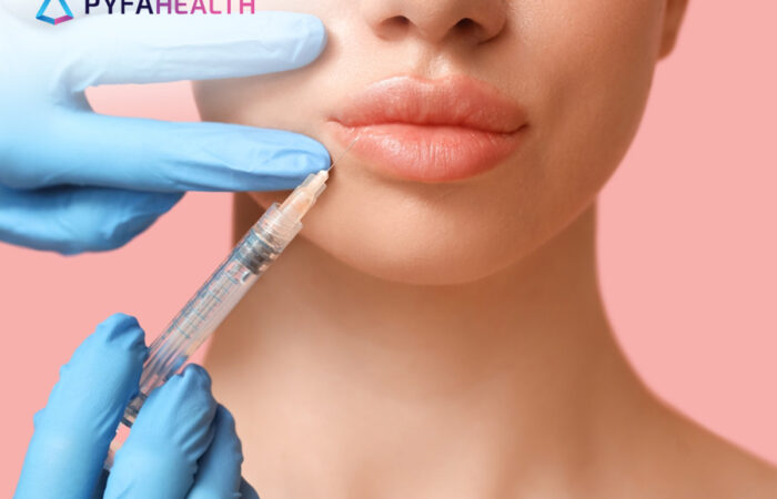 Manfaat Filler Bibir dengan Hasil Alami