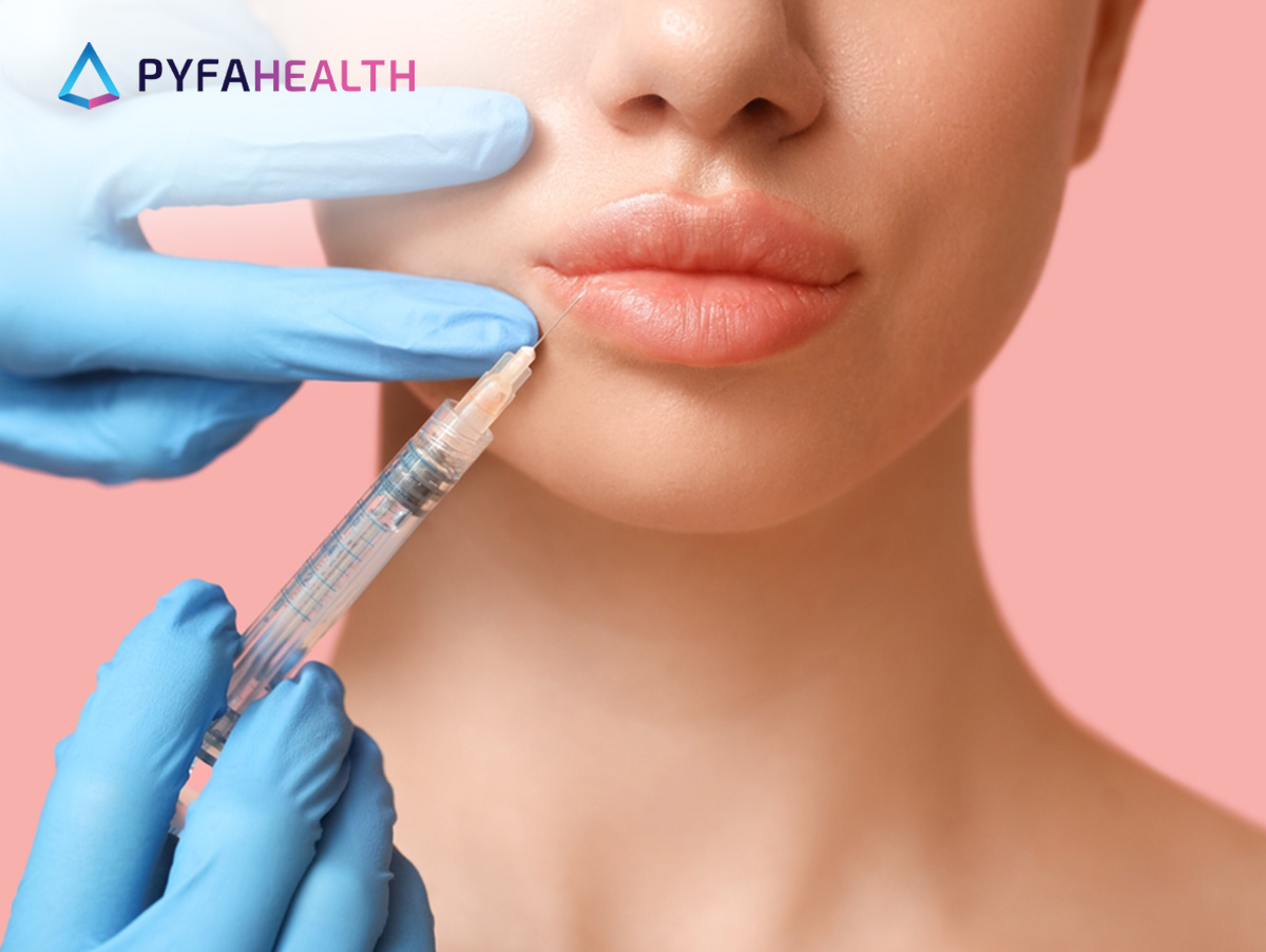 Manfaat Filler Bibir dengan Hasil Alami