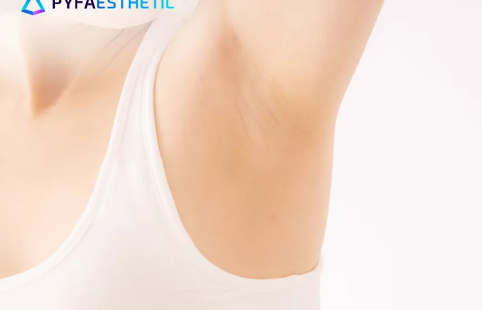 Cara Cepat dan Efektif untuk Mencerahkan Ketiak