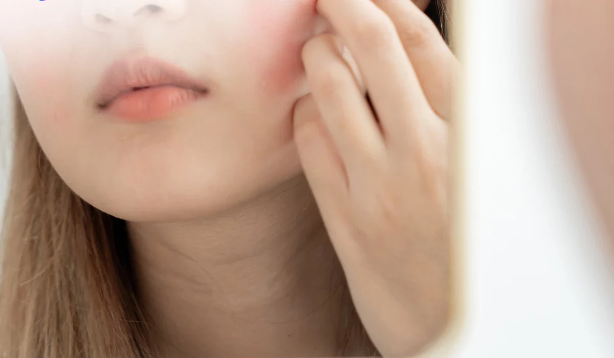 Pertolongan Pertama Saat Skin Barrier Rusak - Stop Eksfoliasi dan Mulai Hidrasi