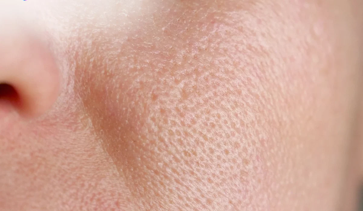 Wajah Mulus Tanpa Filter - Rahasia Memperbaiki Tampilan Pori-Pori dengan GwangFeel