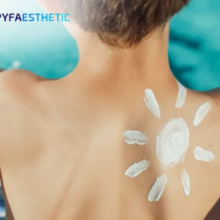 Cara Memilih Sunscreen yang Tepat untuk Kulit Sensitif