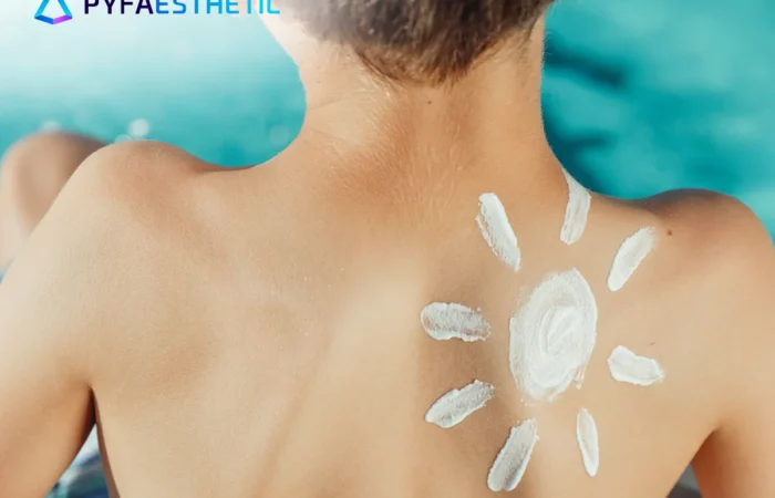 Cara Memilih Sunscreen yang Tepat untuk Kulit Sensitif